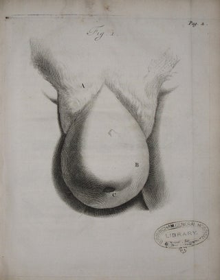 Observationum Anatomico-Chirurgicarum Centuria Accedit Catalogus Rariorum, quae in Museo Ruyschiano asservantur...