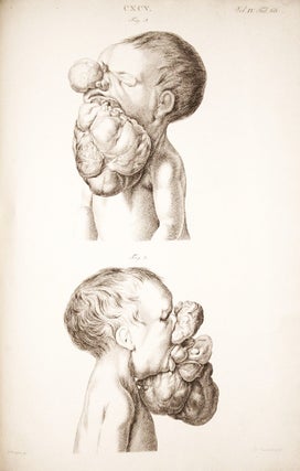 Item #001790 Museum Anatomicum Acadamiae Lugduno-Batavae. Gerard SANDIFORT