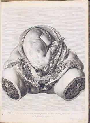 Item #001945 Anatomia uteri humani gravidi tabulis illustrata. The Anatomy of the Human Gravid...