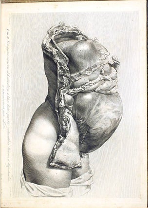 Anatomia uteri humani gravidi tabulis illustrata. The Anatomy of the Human Gravid Uterus exhibited in Figures.