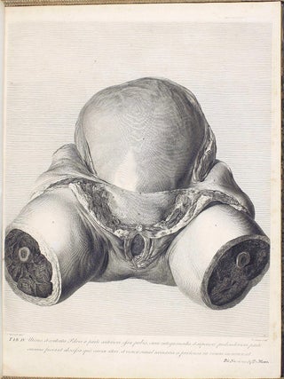 Anatomia uteri humani gravidi tabulis illustrata. The Anatomy of the Human Gravid Uterus exhibited in Figures.
