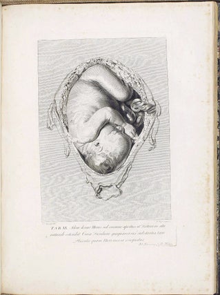 Anatomia uteri humani gravidi tabulis illustrata. The Anatomy of the Human Gravid Uterus exhibited in Figures.