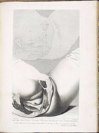 Anatomia uteri humani gravidi tabulis illustrata. The Anatomy of the Human Gravid Uterus exhibited in Figures.