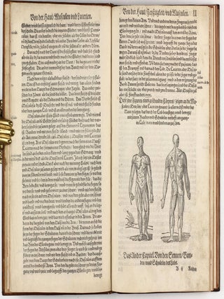 Feldtbuch der Wundt Artzney, sampt des Menschen Cörpers Anatomey, unnd chirurgischen Instrumenten, warhafftig Abcontrafeyt, und beschrieben
