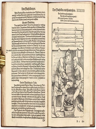 Feldtbuch der Wundt Artzney, sampt des Menschen Cörpers Anatomey, unnd chirurgischen Instrumenten, warhafftig Abcontrafeyt, und beschrieben