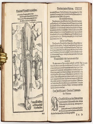 Feldtbuch der Wundt Artzney, sampt des Menschen Cörpers Anatomey, unnd chirurgischen Instrumenten, warhafftig Abcontrafeyt, und beschrieben