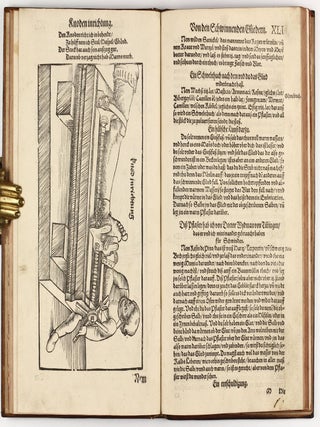 Feldtbuch der Wundt Artzney, sampt des Menschen Cörpers Anatomey, unnd chirurgischen Instrumenten, warhafftig Abcontrafeyt, und beschrieben