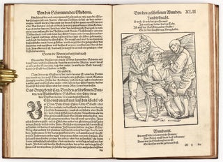 Feldtbuch der Wundt Artzney, sampt des Menschen Cörpers Anatomey, unnd chirurgischen Instrumenten, warhafftig Abcontrafeyt, und beschrieben