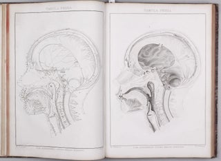 Item #002318 Sammelband with four anatomical works by Soemmerring. Samuel Theodor von SOEMMERRING