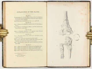 Treatise on the Excision of Diseased Joints