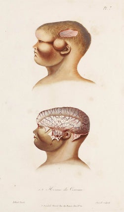 Item #002710 Traité des maladies des enfans nouveaux-nés et a la mamelle. . . / Atlas...