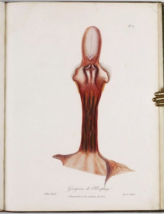 Traité des maladies des enfans nouveaux-nés et a la mamelle. . . / Atlas d'anatomie pathologique pour servir a l'histoire des maladies des enfans.