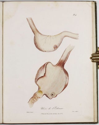 Traité des maladies des enfans nouveaux-nés et a la mamelle. . . / Atlas d'anatomie pathologique pour servir a l'histoire des maladies des enfans.