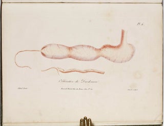 Traité des maladies des enfans nouveaux-nés et a la mamelle. . . / Atlas d'anatomie pathologique pour servir a l'histoire des maladies des enfans.