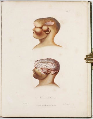 Traité des maladies des enfans nouveaux-nés et a la mamelle. . . / Atlas d'anatomie pathologique pour servir a l'histoire des maladies des enfans.