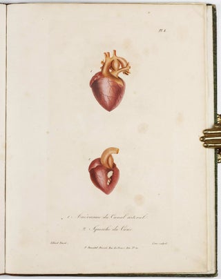Traité des maladies des enfans nouveaux-nés et a la mamelle. . . / Atlas d'anatomie pathologique pour servir a l'histoire des maladies des enfans.