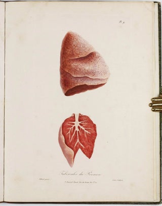 Traité des maladies des enfans nouveaux-nés et a la mamelle. . . / Atlas d'anatomie pathologique pour servir a l'histoire des maladies des enfans.