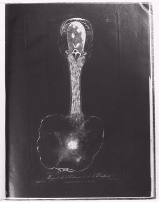 Traité des maladies des enfans nouveaux-nés et a la mamelle. . . / Atlas d'anatomie pathologique pour servir a l'histoire des maladies des enfans.