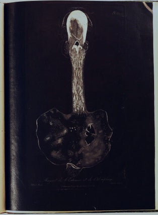 Traité des maladies des enfans nouveaux-nés et a la mamelle. . . / Atlas d'anatomie pathologique pour servir a l'histoire des maladies des enfans.