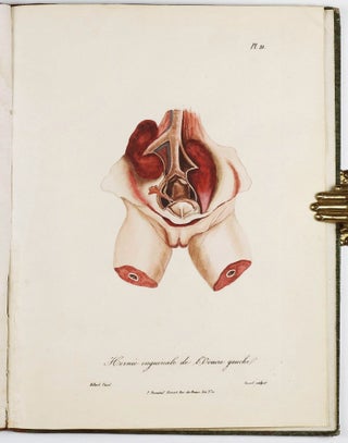 Traité des maladies des enfans nouveaux-nés et a la mamelle. . . / Atlas d'anatomie pathologique pour servir a l'histoire des maladies des enfans.