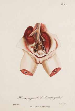 Traité des maladies des enfans nouveaux-nés et a la mamelle. . . / Atlas d'anatomie pathologique pour servir a l'histoire des maladies des enfans.