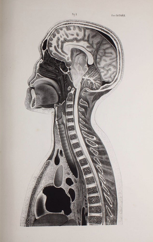 Item #002716 Anatome topographica sectionibus per corpus humanum congelatum triplici directione ductis illustrata. Nikolai Ivanovich PIROGOV.