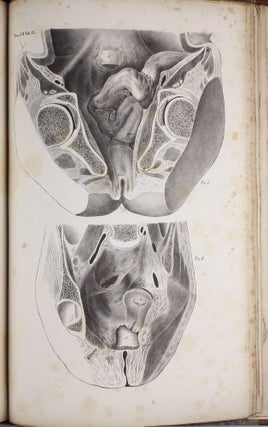 Anatome topographica sectionibus per corpus humanum congelatum triplici directione ductis illustrata.
