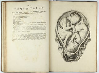 A Sett of Anatomical Tables, with Explanation and an Abridgement of the Practice of Midwifery, with a view to illustrate a treatise on that subject, and collection of cases.