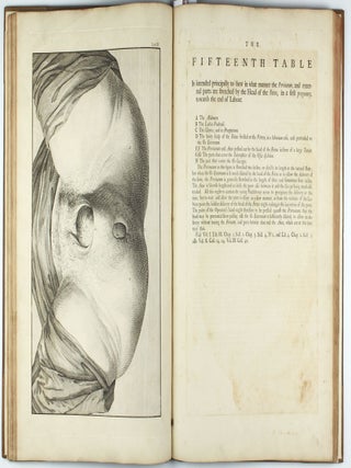 A Sett of Anatomical Tables, with Explanation and an Abridgement of the Practice of Midwifery, with a view to illustrate a treatise on that subject, and collection of cases.
