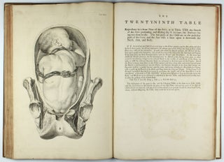 A Sett of Anatomical Tables, with Explanation and an Abridgement of the Practice of Midwifery, with a view to illustrate a treatise on that subject, and collection of cases.