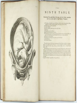 A Sett of Anatomical Tables, with Explanation and an Abridgement of the Practice of Midwifery, with a view to illustrate a treatise on that subject, and collection of cases.