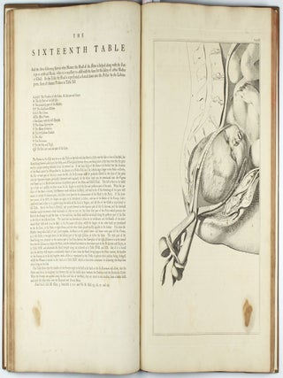 A Sett of Anatomical Tables, with Explanation and an Abridgement of the Practice of Midwifery, with a view to illustrate a treatise on that subject, and collection of cases.