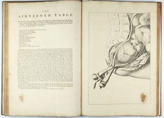 A Sett of Anatomical Tables, with Explanation and an Abridgement of the Practice of Midwifery, with a view to illustrate a treatise on that subject, and collection of cases.