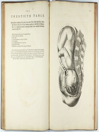 A Sett of Anatomical Tables, with Explanation and an Abridgement of the Practice of Midwifery, with a view to illustrate a treatise on that subject, and collection of cases.