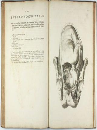 A Sett of Anatomical Tables, with Explanation and an Abridgement of the Practice of Midwifery, with a view to illustrate a treatise on that subject, and collection of cases.