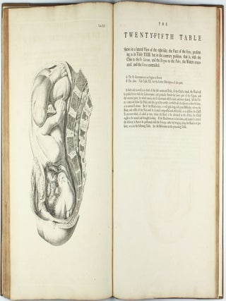 A Sett of Anatomical Tables, with Explanation and an Abridgement of the Practice of Midwifery, with a view to illustrate a treatise on that subject, and collection of cases.