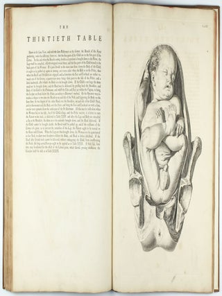 A Sett of Anatomical Tables, with Explanation and an Abridgement of the Practice of Midwifery, with a view to illustrate a treatise on that subject, and collection of cases.