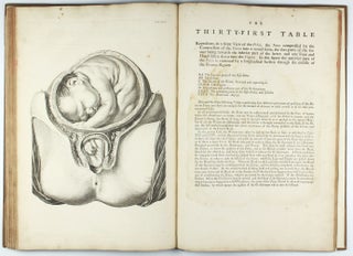 A Sett of Anatomical Tables, with Explanation and an Abridgement of the Practice of Midwifery, with a view to illustrate a treatise on that subject, and collection of cases.