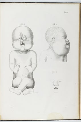 Monstrorum sexcentorum descriptio anatomica / Museum anatomico-pathologicum Vratislaviense.