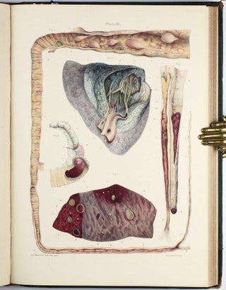 Pathological Anatomy. Illustrations of the Elementary Forms of Diseases.