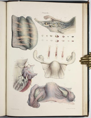 Pathological Anatomy. Illustrations of the Elementary Forms of Diseases.