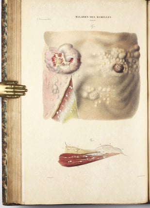 Anatomie pathologique du corps humain.