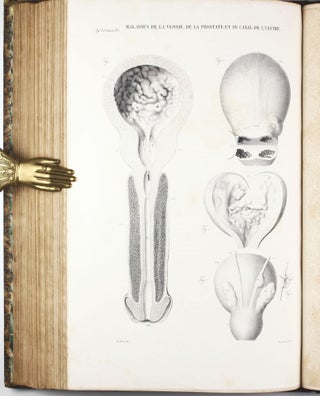 Anatomie pathologique du corps humain.