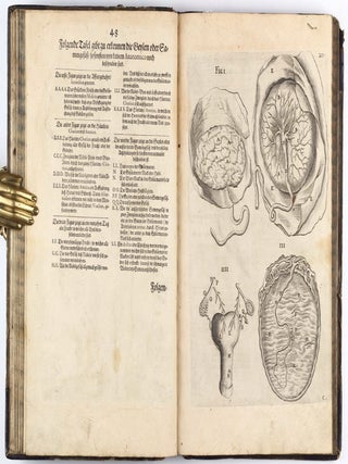 Anatomia, das ist sinnreiche, künstliche, begründete Auffschneidung, Theilung, unnd Zerlegung eines vollkommenen menschlichen Leibs und Cörpers, durch alle desselbigen jnnerliche und eusserliche Gliedtmassen und Gefäss, so wol mit eygendtlicher Beschreibung erkläret, als mit lebendigen Contrafacturen fürgebildet . . .