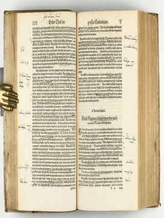 Opus chyrurgicum, warhaffte unnd vollkomne Wundartznei ...; darinn begriffen wie die Wunden, offnen Schäden, Gewächs, Gebresten, Frantzosen, Blatern, Beulen, Lähmi, allerley Zufäll unnd Kranckheiten, auch kalter und warmer Brandt, Fistel und Wolff ... curiert werden sollend / Die grosz Chirurgei, oder volkommene Wundtartzenei; chirurgischen Handtwirckung eigentlicher Bericht, und Inhalt alles so der Wundartznei angehörig; mit künstlicher Fürmalung, klarer Beschreibung . . . aller hierzu dienlicher und gebreuchlicher Instrument oder Ferrament / De Materia chirurgica libri tres, recens aucti authore atque recogniti.