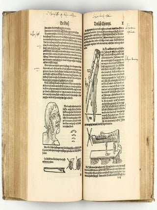 Opus chyrurgicum, warhaffte unnd vollkomne Wundartznei ...; darinn begriffen wie die Wunden, offnen Schäden, Gewächs, Gebresten, Frantzosen, Blatern, Beulen, Lähmi, allerley Zufäll unnd Kranckheiten, auch kalter und warmer Brandt, Fistel und Wolff ... curiert werden sollend / Die grosz Chirurgei, oder volkommene Wundtartzenei; chirurgischen Handtwirckung eigentlicher Bericht, und Inhalt alles so der Wundartznei angehörig; mit künstlicher Fürmalung, klarer Beschreibung . . . aller hierzu dienlicher und gebreuchlicher Instrument oder Ferrament / De Materia chirurgica libri tres, recens aucti authore atque recogniti.