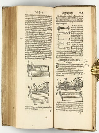 Opus chyrurgicum, warhaffte unnd vollkomne Wundartznei ...; darinn begriffen wie die Wunden, offnen Schäden, Gewächs, Gebresten, Frantzosen, Blatern, Beulen, Lähmi, allerley Zufäll unnd Kranckheiten, auch kalter und warmer Brandt, Fistel und Wolff ... curiert werden sollend / Die grosz Chirurgei, oder volkommene Wundtartzenei; chirurgischen Handtwirckung eigentlicher Bericht, und Inhalt alles so der Wundartznei angehörig; mit künstlicher Fürmalung, klarer Beschreibung . . . aller hierzu dienlicher und gebreuchlicher Instrument oder Ferrament / De Materia chirurgica libri tres, recens aucti authore atque recogniti.