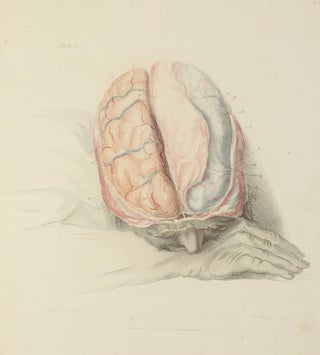 Item #003487 The Anatomy of the Brain, Explained in a Series of Engravings. Charles BELL