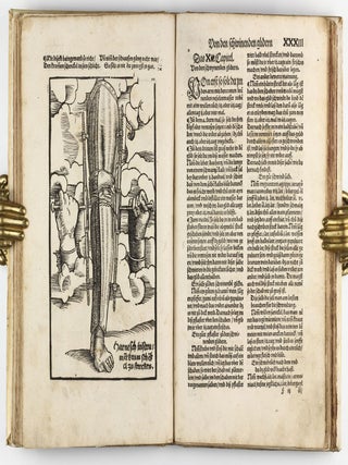 Feldtbuch der Wundtartzney.