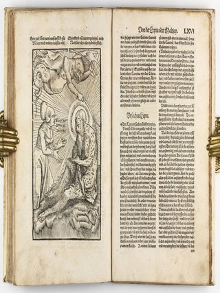 Feldtbuch der Wundtartzney.